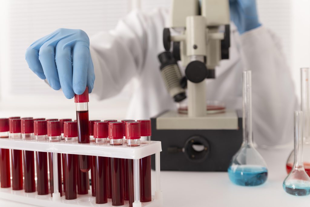 Lab technician in blue gloves holding a blood sample for hormone and liver function testing during a performance-enhancing drug (PED) cycle.